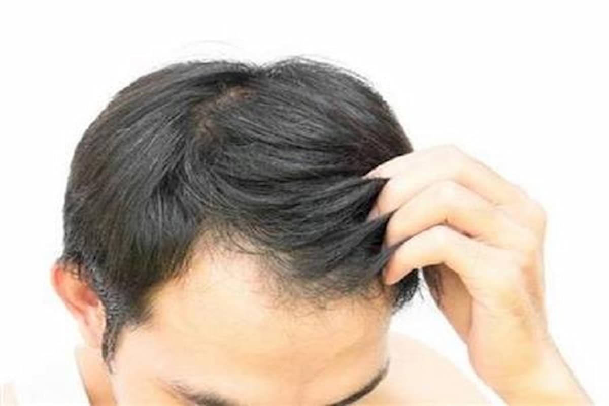 تفسير حلم صبغ الشعر باللون الأسود للرجل