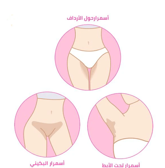 المناطق الحساسة